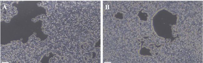 ����hiPSC��(x��)���ΑB(t��i)�D