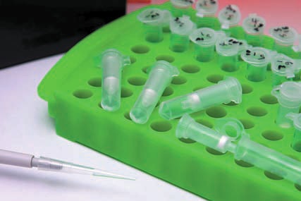 Chromatrap&reg; Pro-A ��һ�N��ʽ����Ⱦɫ�|(zh��)���߳�������(y��ng) (ChIP) �y(c��)�����g(sh��)���ɹ����x����(f��)�s��Ƭ�����еĸ��|(zh��)��Ⱦɫ�|(zh��)���˴Α�(y��ng)��ע�س�����ԭʼ�ӌm��(n��i)Ĥ�g�|(zh��)��(x��)���еı��^�z����(bi��o)ӛ���Y(ji��)������ Chromatrap&reg; ���g(sh��)�ĽM����Ƭ�� 1 ���f(w��n)��(g��)��(x��)���гɹ����x���˴����ı��^�z����(bi��o)ӛ������(du��)��� IgG ����Ի���λ�c(di��n)���x���Ե������˻����ӻ���Ŀ��(bi��o)�� 