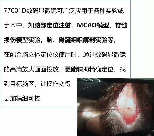 ��(sh��)�a�@΢�R�r��